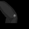 SPORK, NICO - 22.03.1976 - 02.08.2022 - CT obere Extremität - 18:01:46